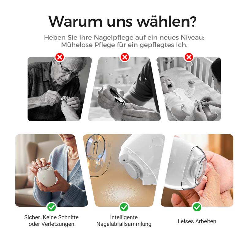 ✂️ AUTOMATISCHER NAGELSCHNEIDER – Schnell, Sicher &amp; Mühelos für Alle Altersgruppen