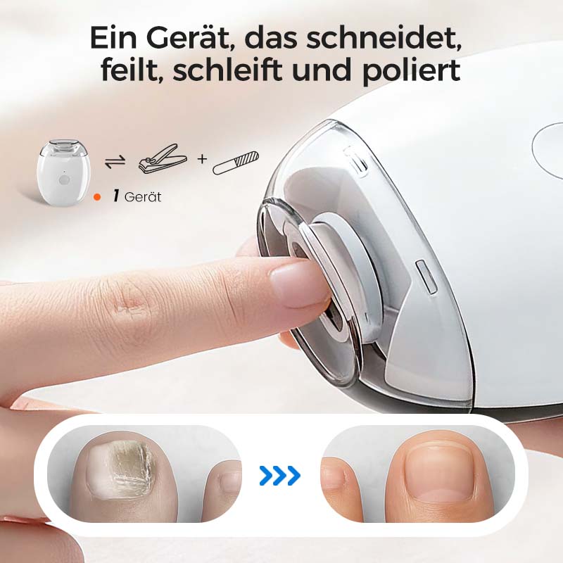 ✂️ AUTOMATISCHER NAGELSCHNEIDER – Schnell, Sicher &amp; Mühelos für Alle Altersgruppen