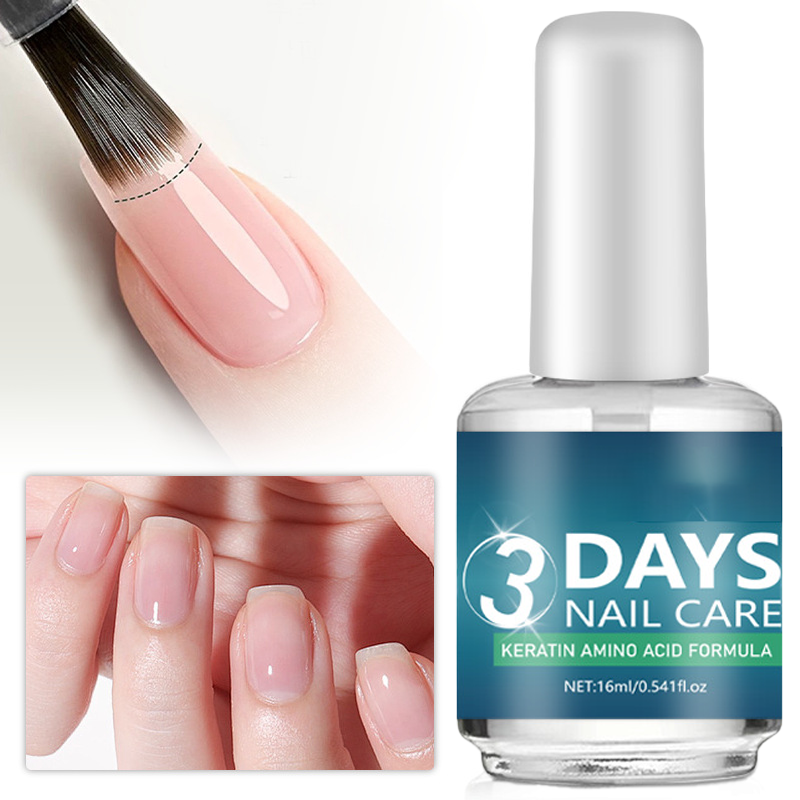📢📢50% Rabatt!! + MEHRKAUF-BONUS 🏆 💅 Hochglänzendes Nagelöl – Brüchige Nägel Vergessen! Glänzend, Stark &amp; Pflegt in Sekunden! ✨