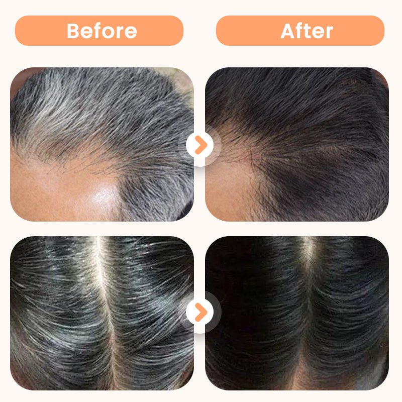 🔥🥰Haarfärbemittel mit Pflanzenextrakten für graues Haar