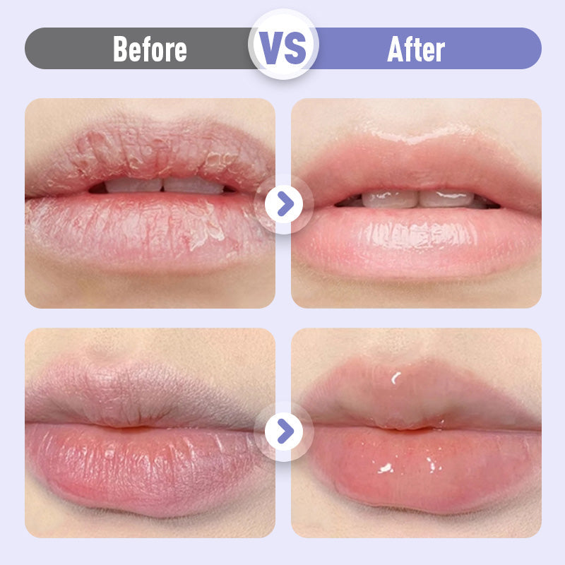 📢📢46 % Rabatt !!Aufpolsterndes und feuchtigkeitsspendendes Lippenserum gegen Falten